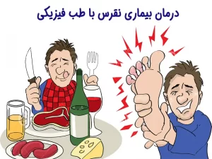 درمان بیماری نقرس
