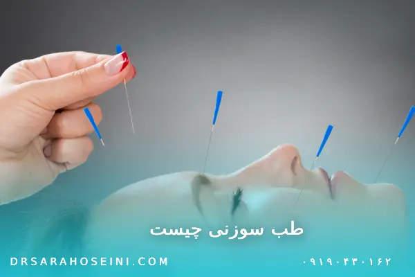 طب سوزنی