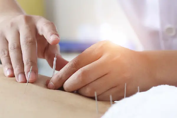 عوارض طب سوزنی