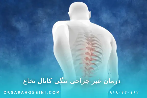 درمان غیر جراحی تنگی کانال نخاع