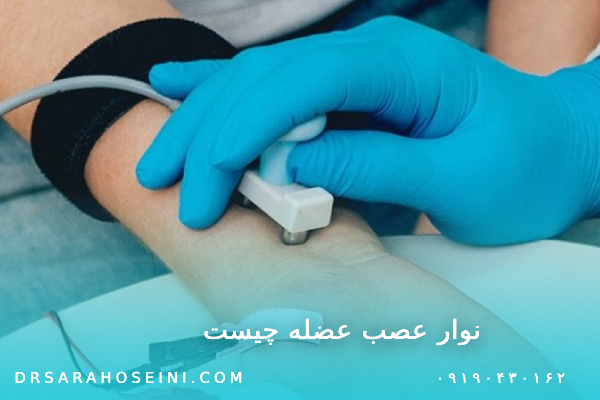 نوار عصب عضله