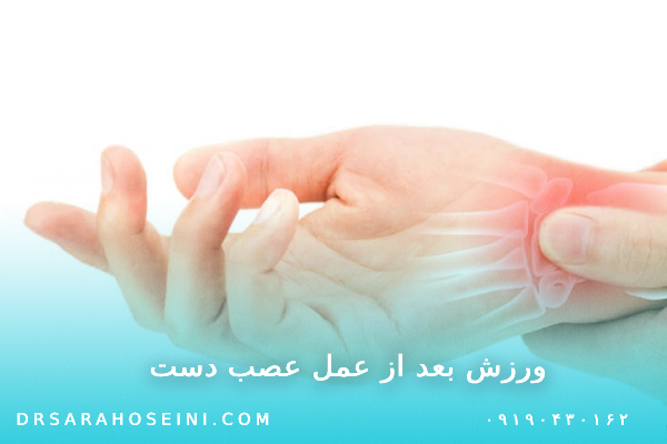 ورزش بعد از عمل عصب دست