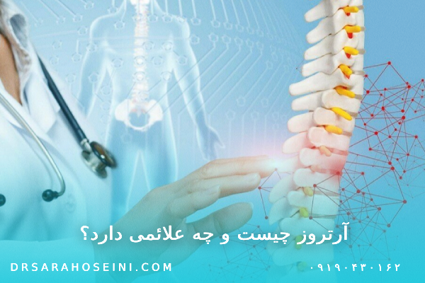 آرتروز چیست