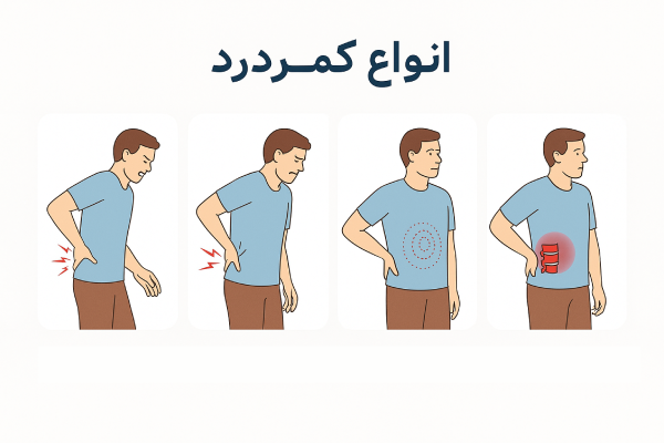 عکس انواع کمردرد