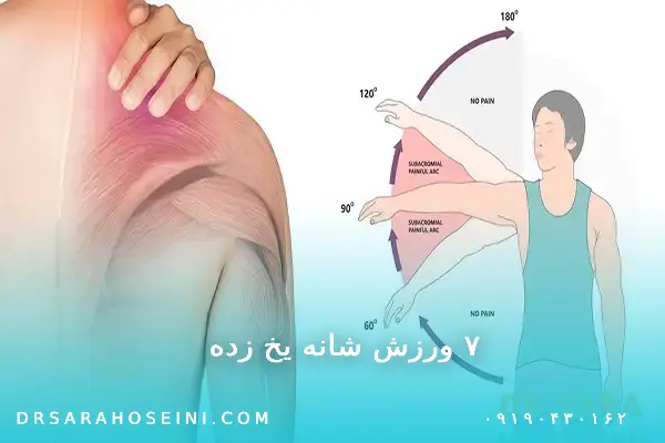 ورزش شانه یخ زده