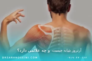 آرتروز شانه چیست