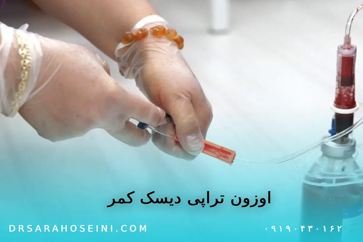 اوزون تراپی دیسک کمر