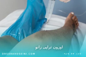اوزون تراپی زانو