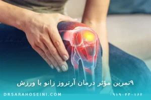 ۹‌تمرین مؤثر درمان آرتروز زانو با ورزش
