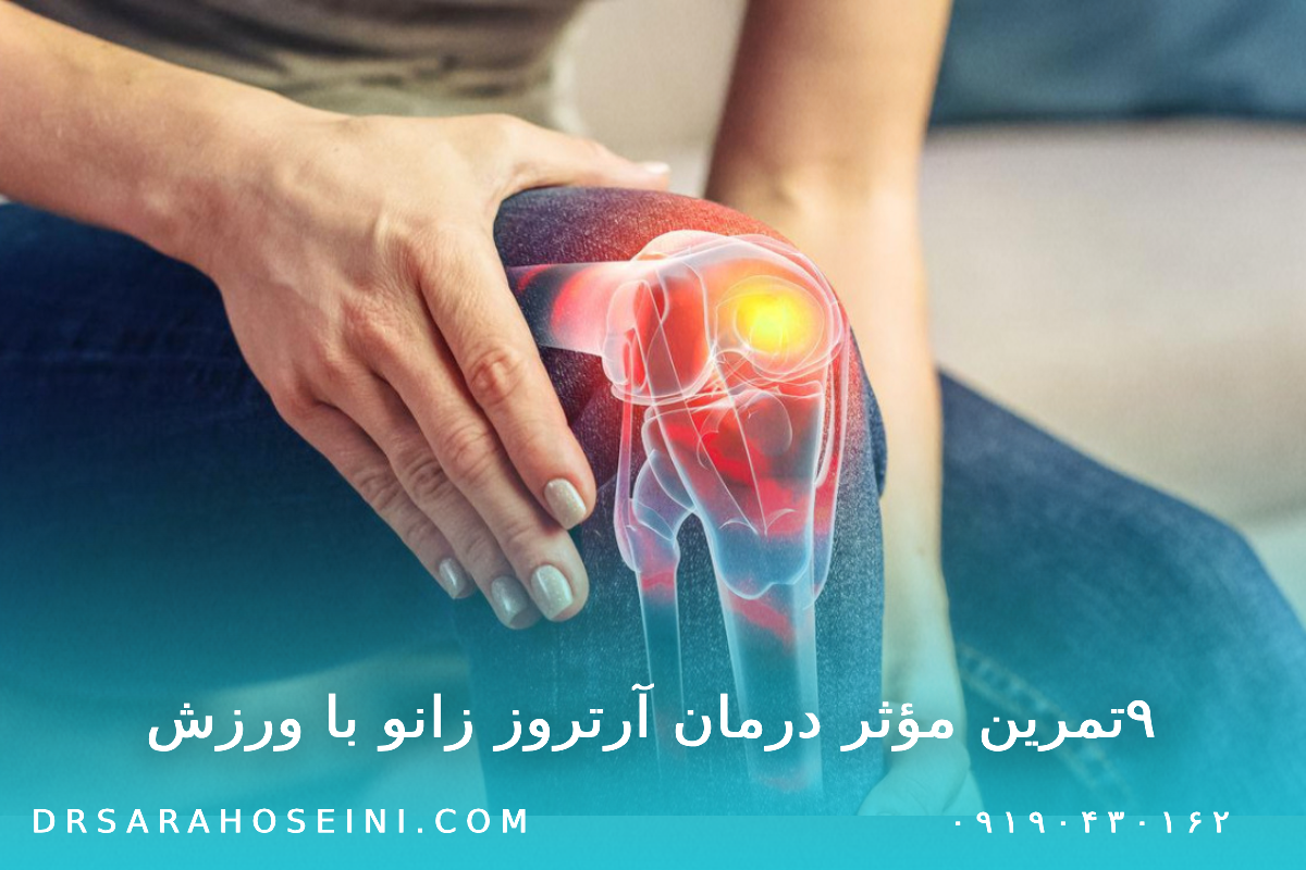 ۹‌تمرین مؤثر درمان آرتروز زانو با ورزش