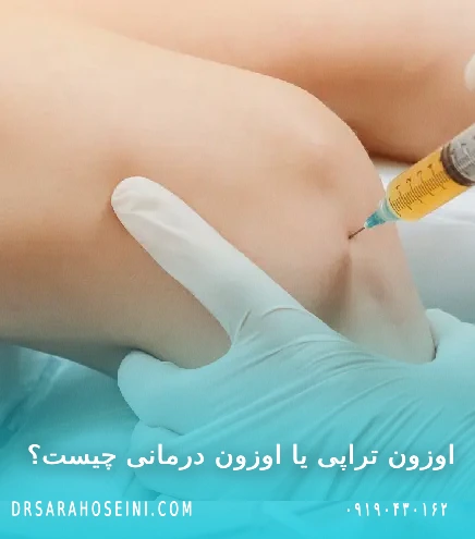 اوزون تراپی یا اوزون درمانی چیست