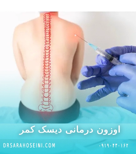 اوزون تراپی دیسک کمر