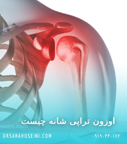 اوزون تراپی شانه