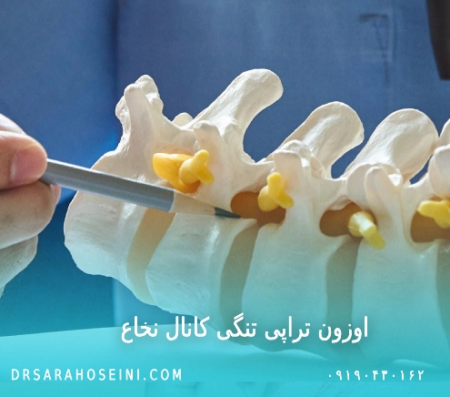 اوزون تراپی تنگی کانال نخاع