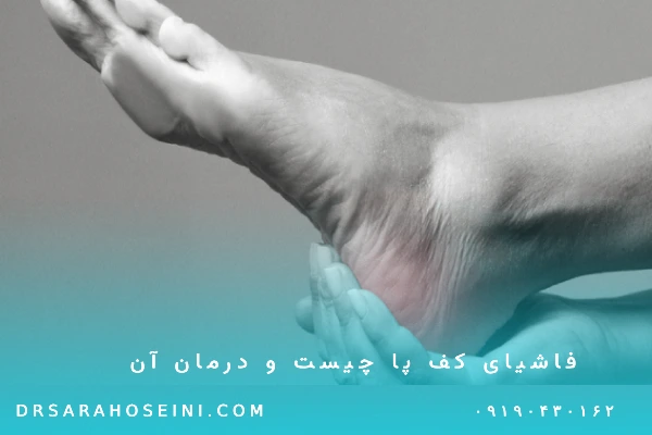 فاشیای کف پا