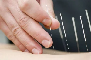 طب سوزنی چه بیماری‌هایی را درمان می‌کند