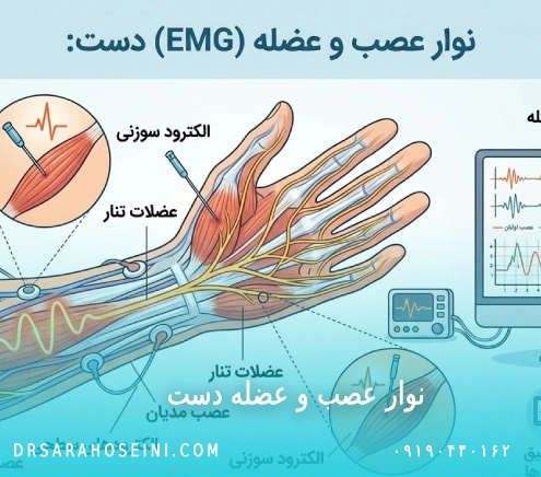 نوار عصب و عضله دست